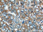 GAB2 Antibody in Immunohistochemistry (Paraffin) (IHC (P))