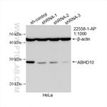 ABHD10 Antibody in Western Blot (WB)