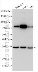 ABHD10 Antibody in Western Blot (WB)