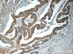 ARAP3 Antibody in Immunohistochemistry (Paraffin) (IHC (P))