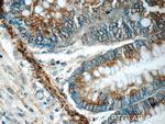 ARAP3 Antibody in Immunohistochemistry (Paraffin) (IHC (P))