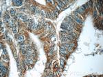 ARAP3 Antibody in Immunohistochemistry (Paraffin) (IHC (P))