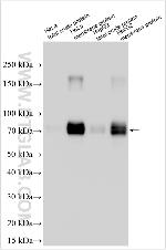 MUPP1 Antibody in Western Blot (WB)