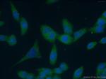 BCR Antibody in Immunocytochemistry (ICC/IF)