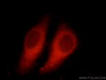 BCR Antibody in Immunocytochemistry (ICC/IF)