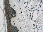 BCR Antibody in Immunohistochemistry (Paraffin) (IHC (P))