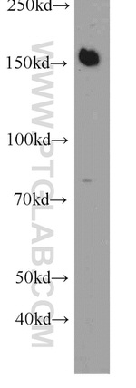 BCR Antibody in Western Blot (WB)