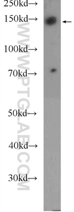 BCR Antibody in Western Blot (WB)