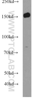 BCR Antibody in Western Blot (WB)