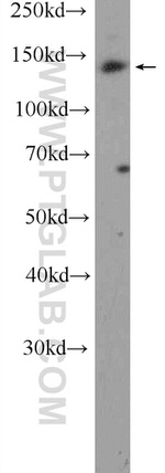 BCR Antibody in Western Blot (WB)