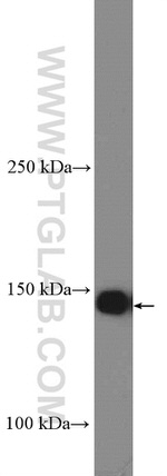 BCR Antibody in Western Blot (WB)