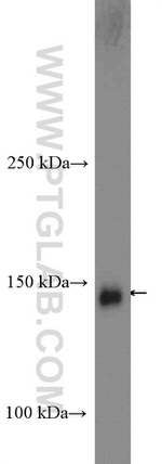 BCR Antibody in Western Blot (WB)