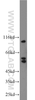 PRICKLE1 Antibody in Western Blot (WB)
