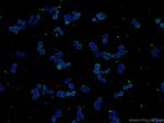 VEGFC Antibody in Immunocytochemistry (ICC/IF)
