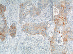 VEGFC Antibody in Immunohistochemistry (Paraffin) (IHC (P))