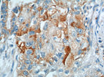 VEGFC Antibody in Immunohistochemistry (Paraffin) (IHC (P))