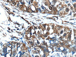 VEGFC Antibody in Immunohistochemistry (Paraffin) (IHC (P))