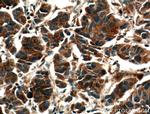VEGFC Antibody in Immunohistochemistry (Paraffin) (IHC (P))