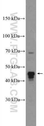 VEGFC Antibody in Western Blot (WB)