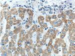FNDC3B Antibody in Immunohistochemistry (Paraffin) (IHC (P))