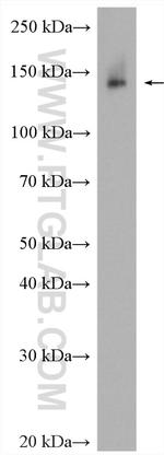 FNDC3B Antibody in Western Blot (WB)