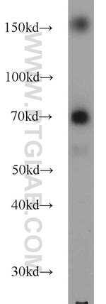 FNDC3B Antibody in Western Blot (WB)