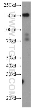 FNDC3B Antibody in Western Blot (WB)