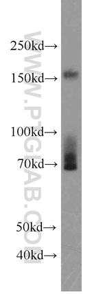 FNDC3B Antibody in Western Blot (WB)