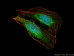 TET3 Antibody in Immunocytochemistry (ICC/IF)