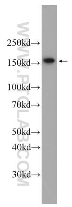 WDR33 Antibody in Western Blot (WB)