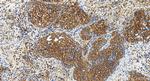 MAGI3 Antibody in Immunohistochemistry (Paraffin) (IHC (P))