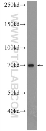 PDE5A Antibody in Western Blot (WB)