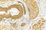 PKP1 Antibody in Immunohistochemistry (Paraffin) (IHC (P))