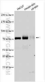 PKP1 Antibody in Western Blot (WB)