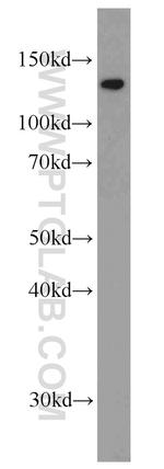 CCAR2 Antibody in Western Blot (WB)