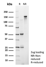 D-Dimer/Fibrinogen gamma chain Antibody in SDS-PAGE (SDS-PAGE)