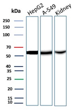 D-Dimer/Fibrinogen gamma chain Recombinant Rabbit Monoclonal Antibody (FGG/13043R)