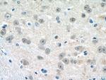 HES5 Antibody in Immunohistochemistry (Paraffin) (IHC (P))