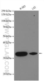 A4GNT Antibody in Western Blot (WB)