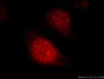 SART1 Antibody in Immunocytochemistry (ICC/IF)