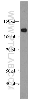 SART1 Antibody in Western Blot (WB)