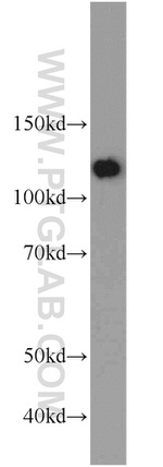 SART1 Antibody in Western Blot (WB)