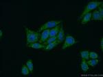 PPP4R2 Antibody in Immunocytochemistry (ICC/IF)