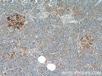 PPP4R2 Antibody in Immunohistochemistry (Paraffin) (IHC (P))