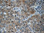 PPP4R2 Antibody in Immunohistochemistry (Paraffin) (IHC (P))