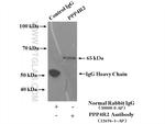 PPP4R2 Antibody in Immunoprecipitation (IP)