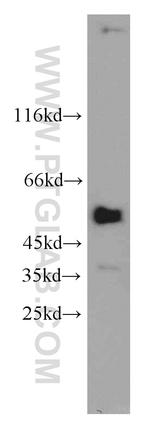 PPP4R2 Antibody in Western Blot (WB)