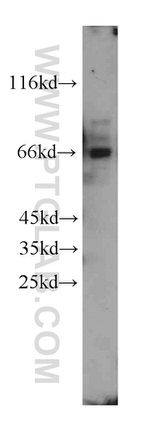 PPP4R2 Antibody in Western Blot (WB)