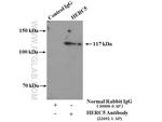 HERC5 Antibody in Immunoprecipitation (IP)