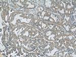 AARS2 Antibody in Immunohistochemistry (Paraffin) (IHC (P))